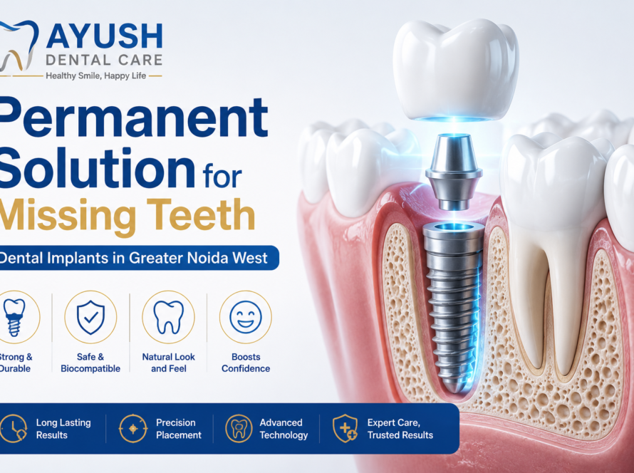 dental-implant-in-greater-noida-west